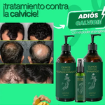 Kit de Crecimiento de Cabello x3 Tónico + Shampoo + Acondicionador Anticaída